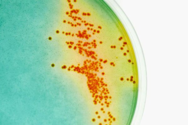 中國發現新型超級細菌完全無藥可醫，「高毒性、高致病、高傳染」讓民眾人心惶惶！