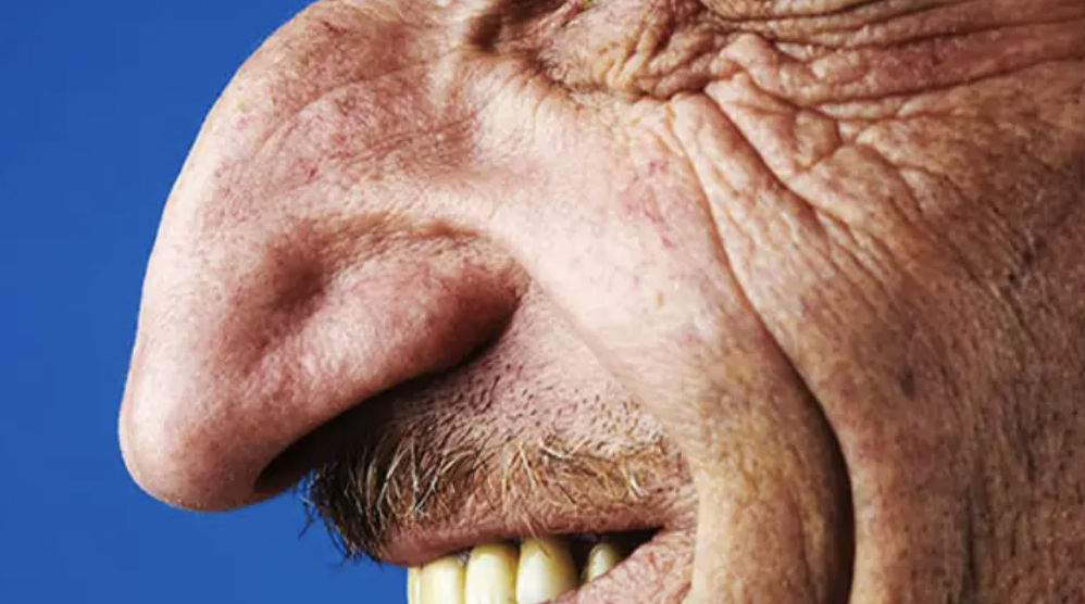 見見世界上最大鼻子的人！　71歲老人「長8.8cm」保持金氏紀錄至今