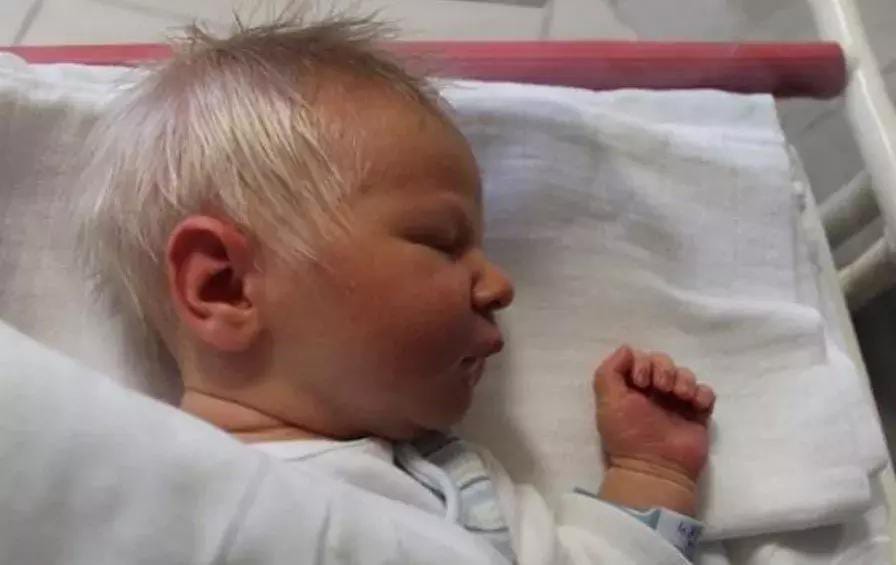 比少年白更早...嬰兒「天生銀白色髮絲」　醫生檢測後發現是人體奇蹟