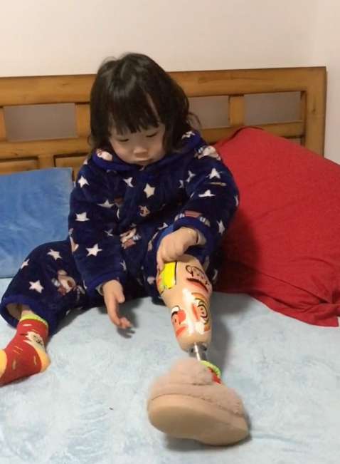小女孩每天起床第一件事「自己裝義肢」　3歲就必須習慣的日常太催淚