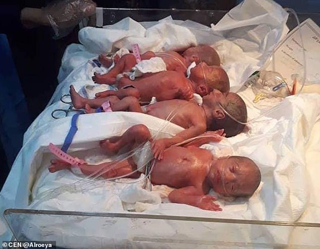 一次生完7胞胎！25歲年輕媽媽成功自然分娩　全世界都獻上祝福