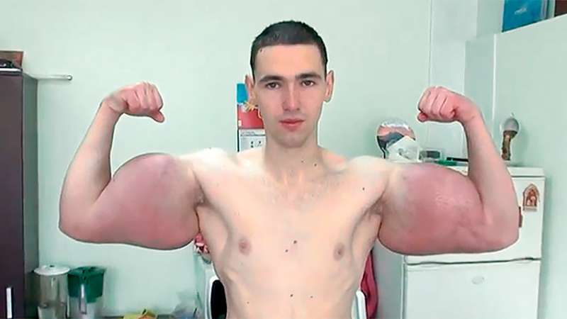 戰鬥民族瘋狂注射類固醇　驕傲秀24吋二頭肌：全俄羅斯最大