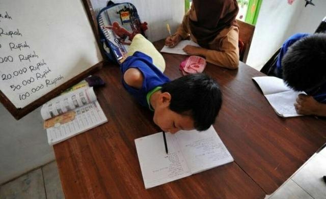 印尼男孩一出生就是「人棍」　只能用頭部自理過日子卻活出讓人讚爆的人生