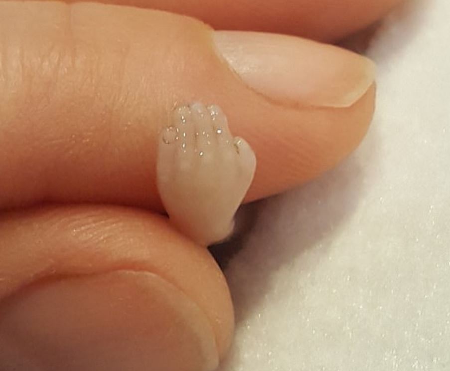 「這是我14週寶寶的小手」　媽媽心碎上傳照片：在醫生眼中竟然是垃圾