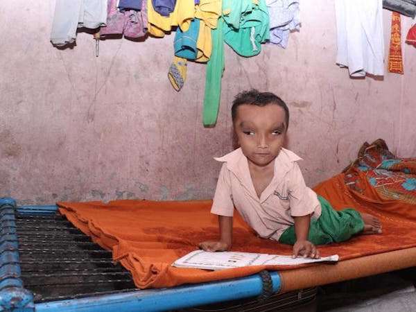 天生大耳細眼…　印度8歲畸形男童「成象鼻神轉世」　他為長相自豪：學校老師同學都崇拜我