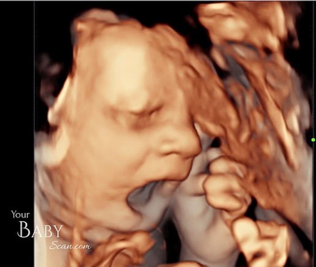 在母胎就金派！胎兒接受4D超聲波掃描　竟然直接「豎出中指」