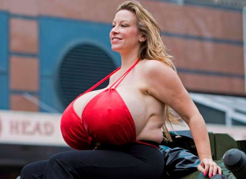 世界第一巨乳！　她整到罩杯181X「乳暈壞掉」　胸部就重30公斤…未來要繼續整