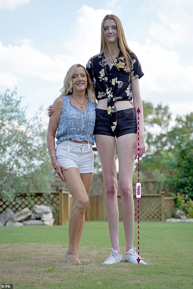 誰站誰變小矮人！「世界最長腿女生」有逆天135cm腿長　更驚人事實：她才17歲