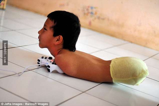 這位小男孩天生沒有四肢生活超困難，但他「靠下巴打電玩還是學術天才」讓校長都驚呆了！