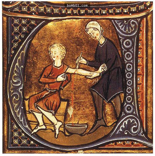 19張「必須把醫生從棺材裡挖出來問為什麼」的中世紀驚悚治病方式。