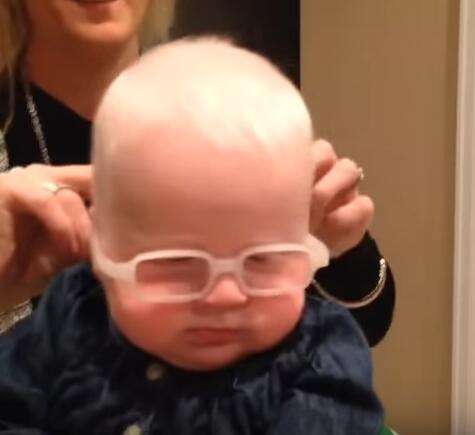 白化症小寶寶第一次戴上眼鏡看清楚媽媽的樣子　她的反應會讓你瞬間融化