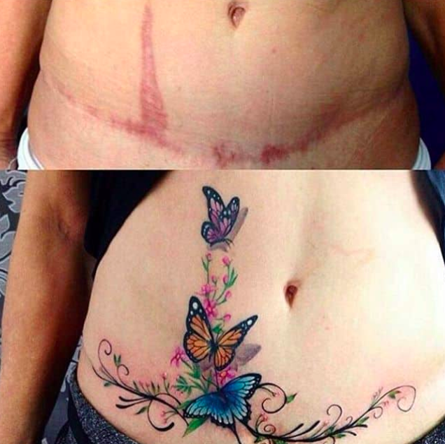 讓妊娠紋神隱　10個「讓大家都不會去注意疤痕」的掩蓋刺青