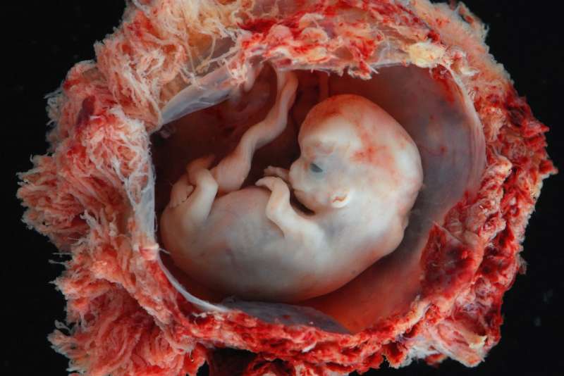 科學家證實「胚胎在8週大時就感覺到疼痛」　墮胎醫師：比成人遭肢解的痛更強烈