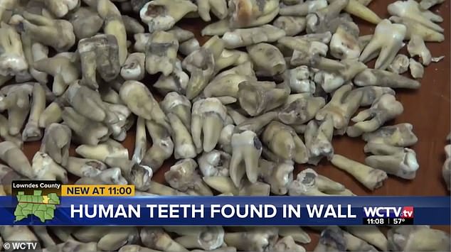 這輩子沒看過那麼多人類牙齒　百年大樓翻修工人驚見「1000顆發黃牙齒」
