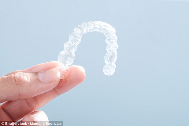 不戴會跑位！牙齒矯正維持器「就是要戴一輩子」，牙醫警告：不然5年後就要再做一次！
