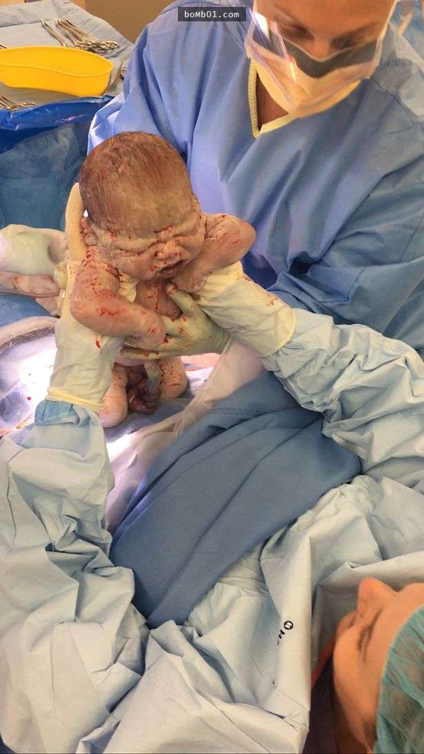 這名孕婦為了想要更有參與感「竟然提出超狂要求」，醫生也只能眼睜睜看著她把寶寶拉出來！