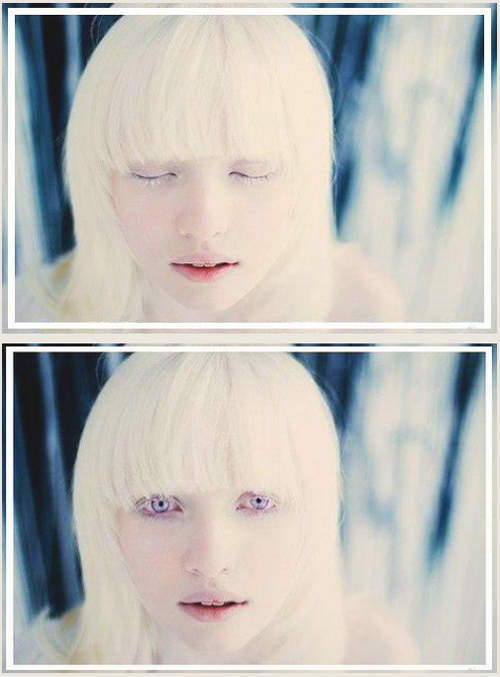 美到不像真人！18歲白化少女宛如雪精靈　千萬分之一「紫羅蘭色雙眸」睜開就驚艷
