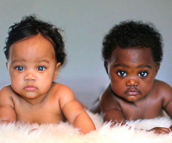 膚色不同的雙胞胎被酸民譏笑「黑檀木 VS 象牙白」，長大後那雙眼睛超迷人「每一秒都在放電」！