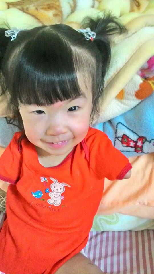 爸爸賣米線照顧「只有一隻左腳」的5歲女兒　她超樂觀面對人生：我不奇怪