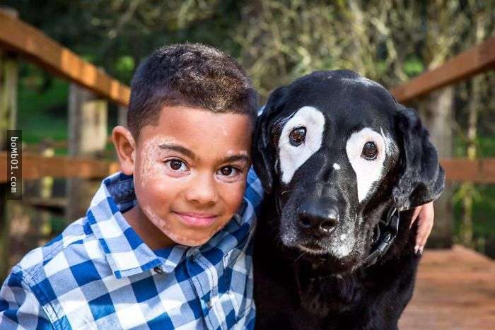 天生有白斑病的8歲男孩從小就「很討厭自己的臉」，直到他遇見了「狗狗版自己」…生命就徹底被改變了！