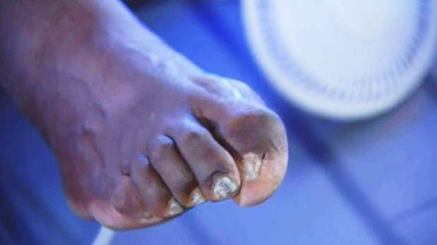 NBA明星球鞋底下的痛...　詹皇露「扭曲腳趾」　粉絲驚：怎麼會這樣？　