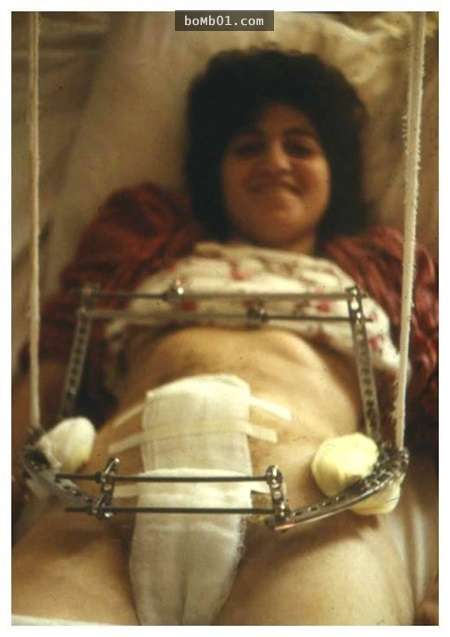 這名孕婦在當年「慘遭活埋流產」導致終生不孕，但28年後…她竟然變成了醫生震驚的模樣！