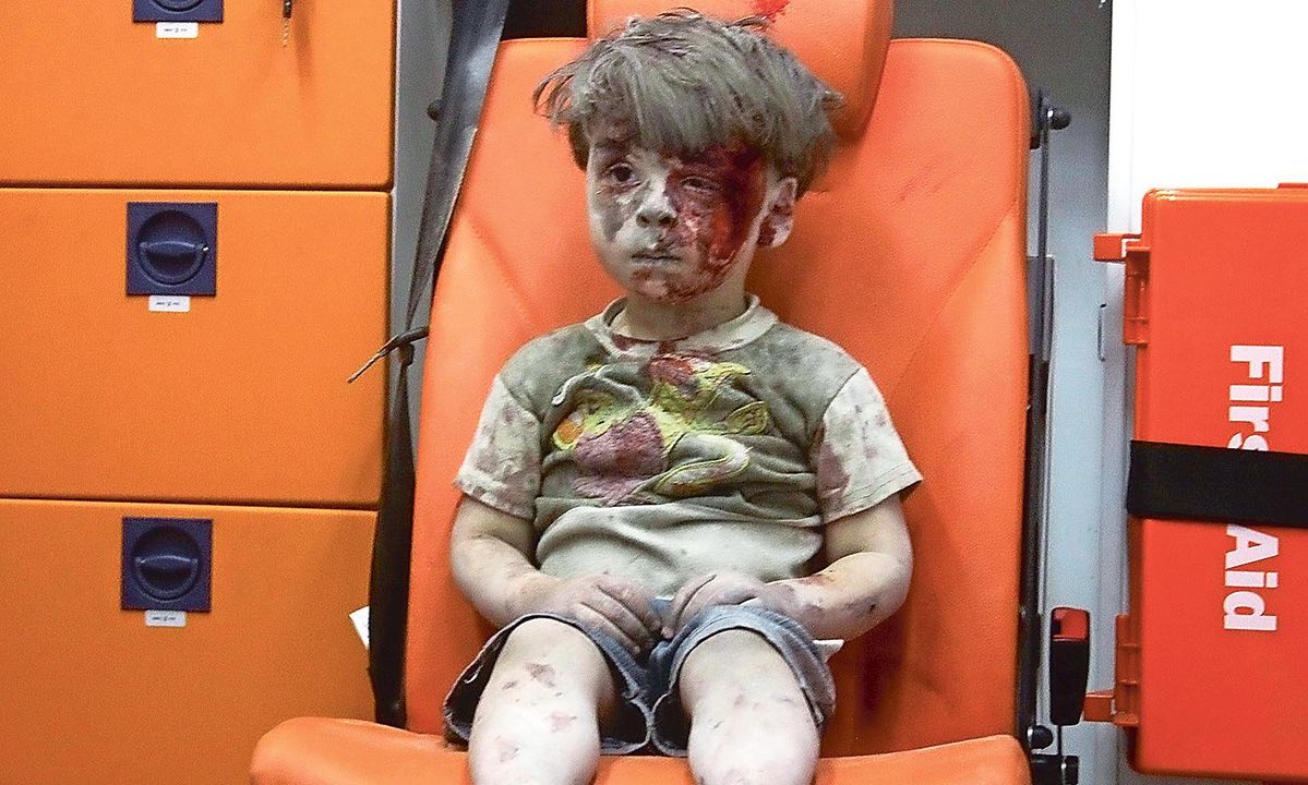 震撼全球的5歲敘利亞男孩「現在已經完全康復」，他現在的激萌模樣讓大家都放心了！