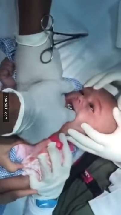 1歲寶寶送進急救室後就被醫生猛摳嘴巴，取出裡面的東西時大家都慶幸他還能得救真的是命大啊！