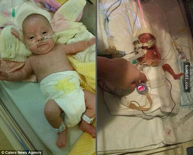 這個27週便早產出生的小寶寶連戒指都可以套進她手臂，被醫生斷言活不久的她最後竟然…