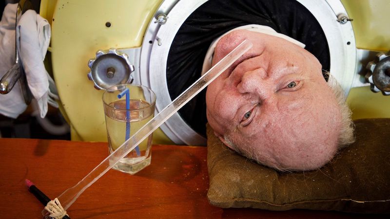 困「鐵肺」70年破世界紀錄！美傳奇勵志男離世　享壽78歲