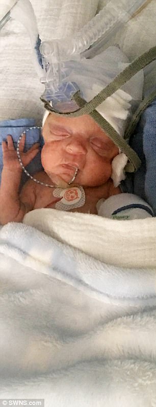 這個手掌寶寶在墮胎期限之前趕著出生，「連內臟都還可以看到」的他現在的狀況連醫生也直呼是奇蹟！