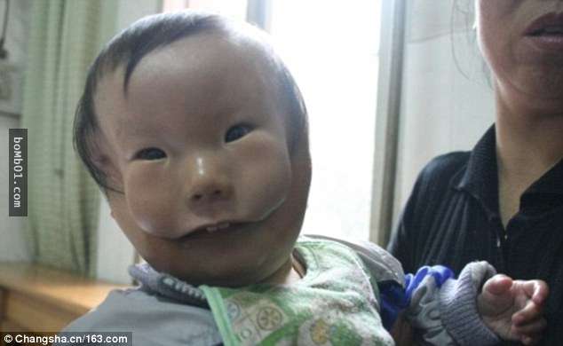 這個「面具娃娃」的故事現在連國際媒體都哭著報導，外國網友也心疼到替他集氣加油！