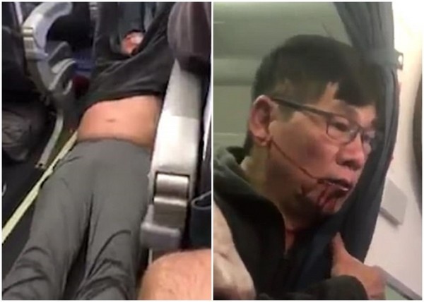 美國聯航各種動作反擊「強拖亞裔醫師事件」失敗，現在竟然放話對付「違規」拍影片的乘客！