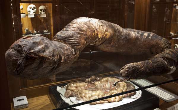 29歲男每月便便一次便秘嚴重　超大「糞味香腸」被放進博物館