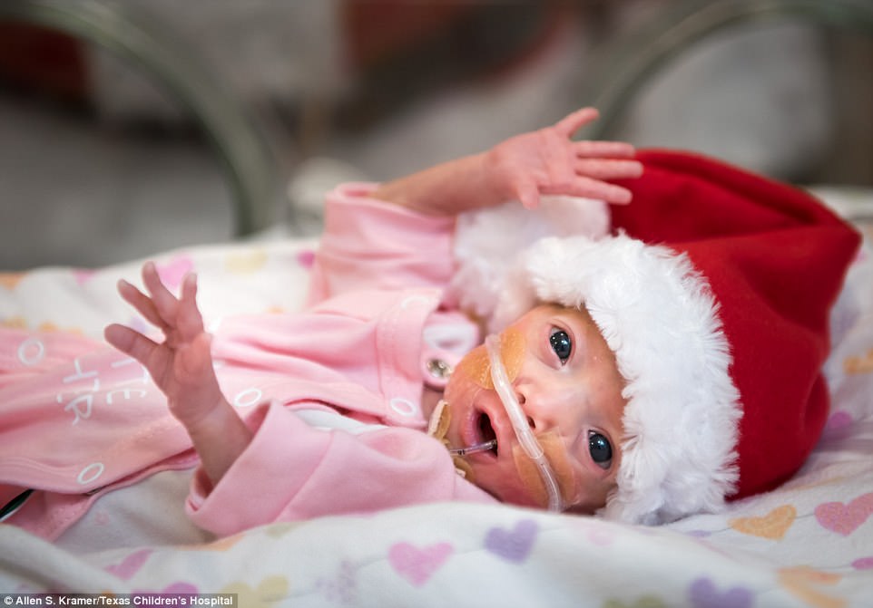 醫院幫加護病房裡的早產兒寶寶穿上聖誕服裝，接著媽媽們轉頭看到他全都開心笑了出來