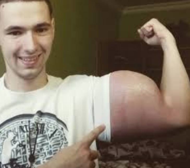 戰鬥民族瘋狂注射類固醇　驕傲秀24吋二頭肌：全俄羅斯最大