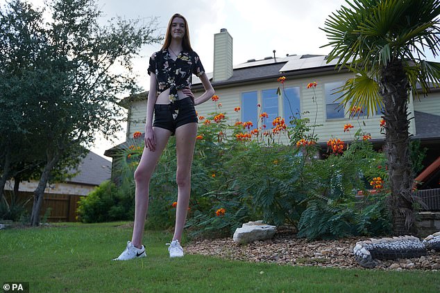 誰站誰變小矮人！「世界最長腿女生」有逆天135cm腿長　更驚人事實：她才17歲