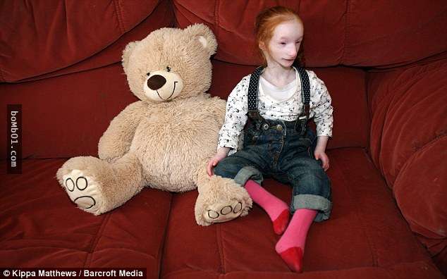 這個寶寶一出生就像一個脆弱的娃娃，5年後醫生完全沒看過像她這樣的女孩…