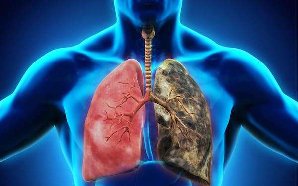 咳嗽總是好不了？　吸菸者高機率罹患「肺阻塞」　廢氣塞爆肺且永遠治不好