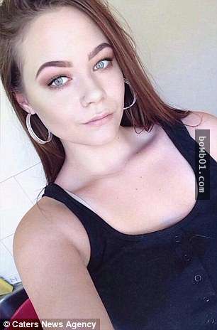 16歲女生「嘗試自己染髮」結果發生過敏反應，接著眼睛的狀況害她差點就變成瞎子！