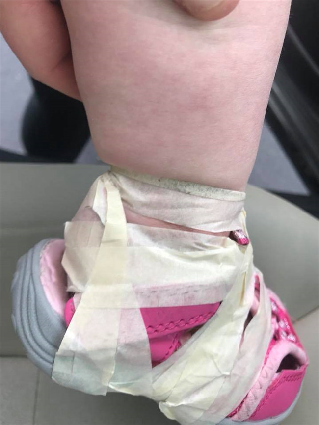 1歲半女兒愛脫鞋「被膠帶綑緊緊」　媽怒控保育員一拆就想流淚