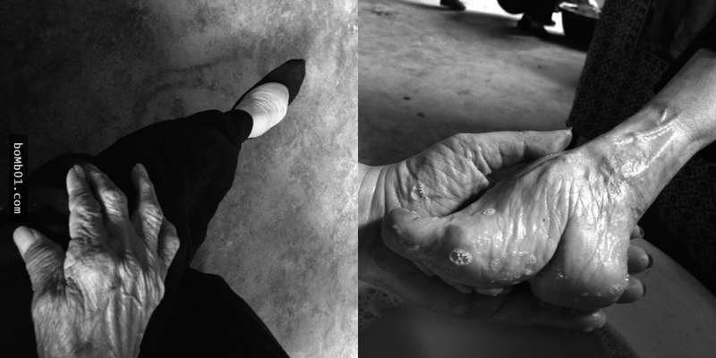 中國最後一批裹小腳女性「終於願意鬆開裹腳布」，親眼看到她們小腳的畸形程度後心都沉了下去…