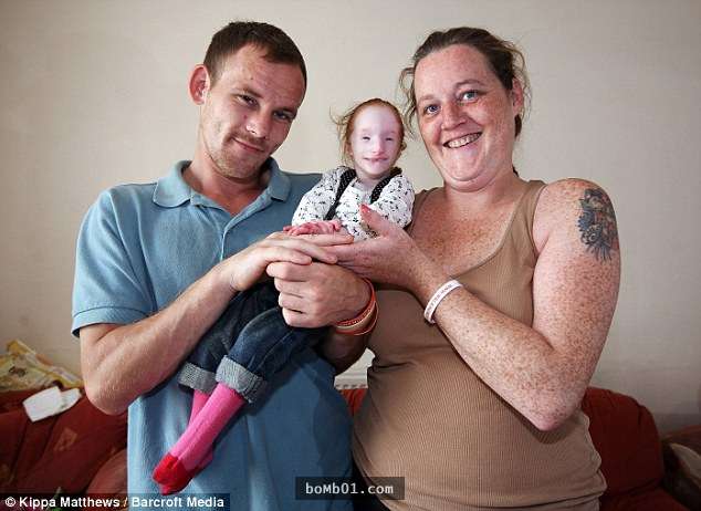 這個寶寶一出生就像一個脆弱的娃娃，5年後醫生完全沒看過像她這樣的女孩…