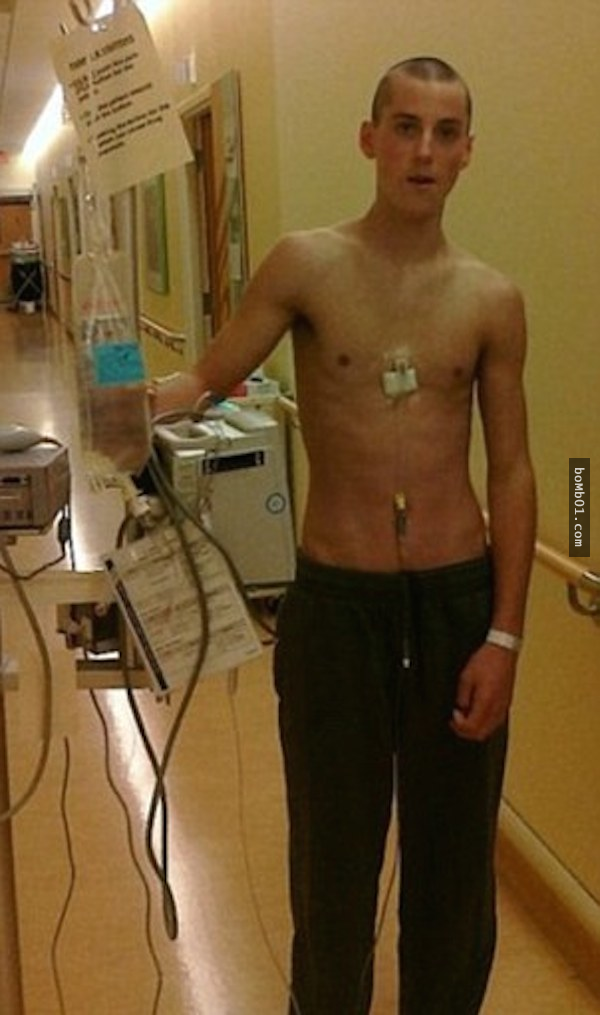 15歲男孩罹癌後變瘦竹竿　他每天健身2小時「竟成功改造身體」