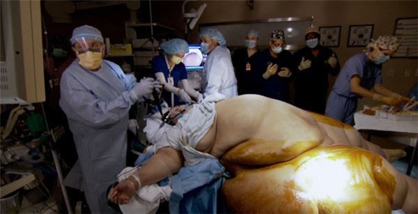 這位450公斤的「世界最胖女」曾稱壓死自己的姪子，狠心減重後…瘦下來的她美得驚人！