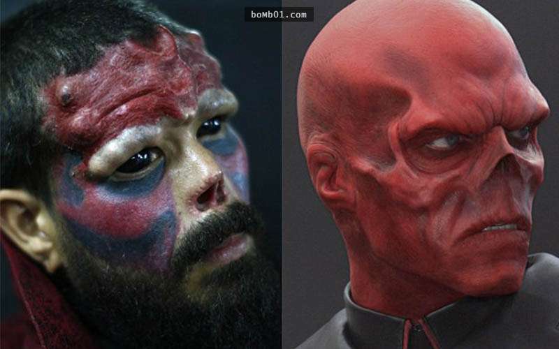 他花百萬把自己的臉「改造」成漫威的紅骷髏角色，鼻子削掉後…現在的模樣沒人敢直視他！