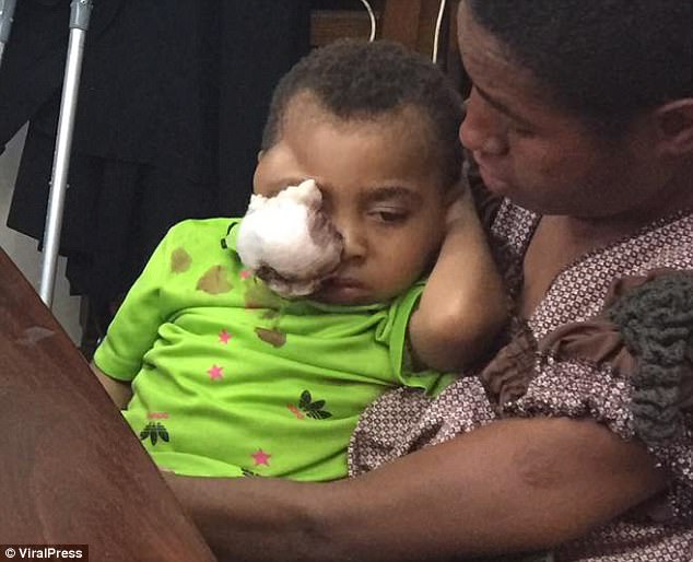 這個3歲小男孩「眼睛被腫瘤吃掉」父母找不到方法救他，結果選擇黑魔法治療造成難以挽回的後果…！
