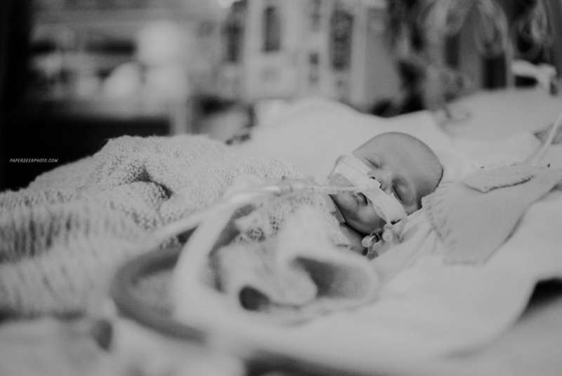 醫生曾預言活不過2週…　心臟病寶寶4年經歷「3次開心手術」　媽媽驚訝：他整個人都變了