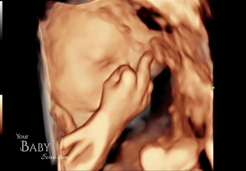 在母胎就金派！胎兒接受4D超聲波掃描　竟然直接「豎出中指」