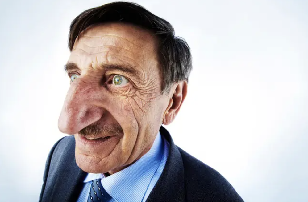 見見世界上最大鼻子的人！　71歲老人「長8.8cm」保持金氏紀錄至今